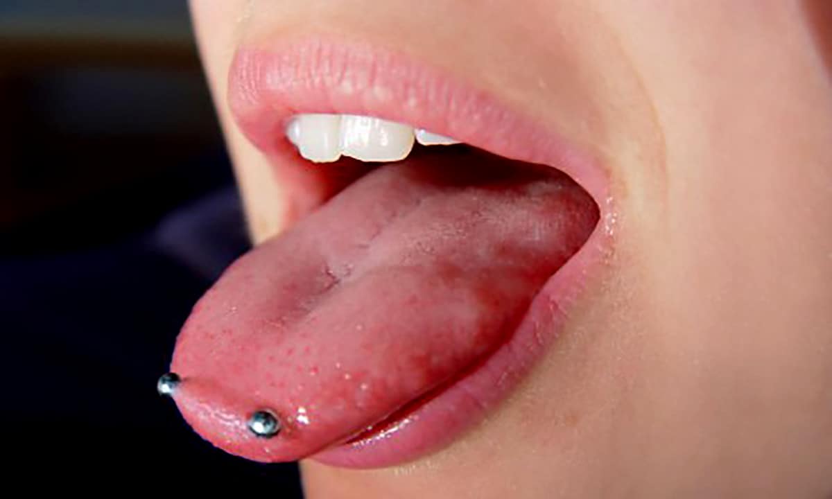 What are the Cons of an Oral Piercing?