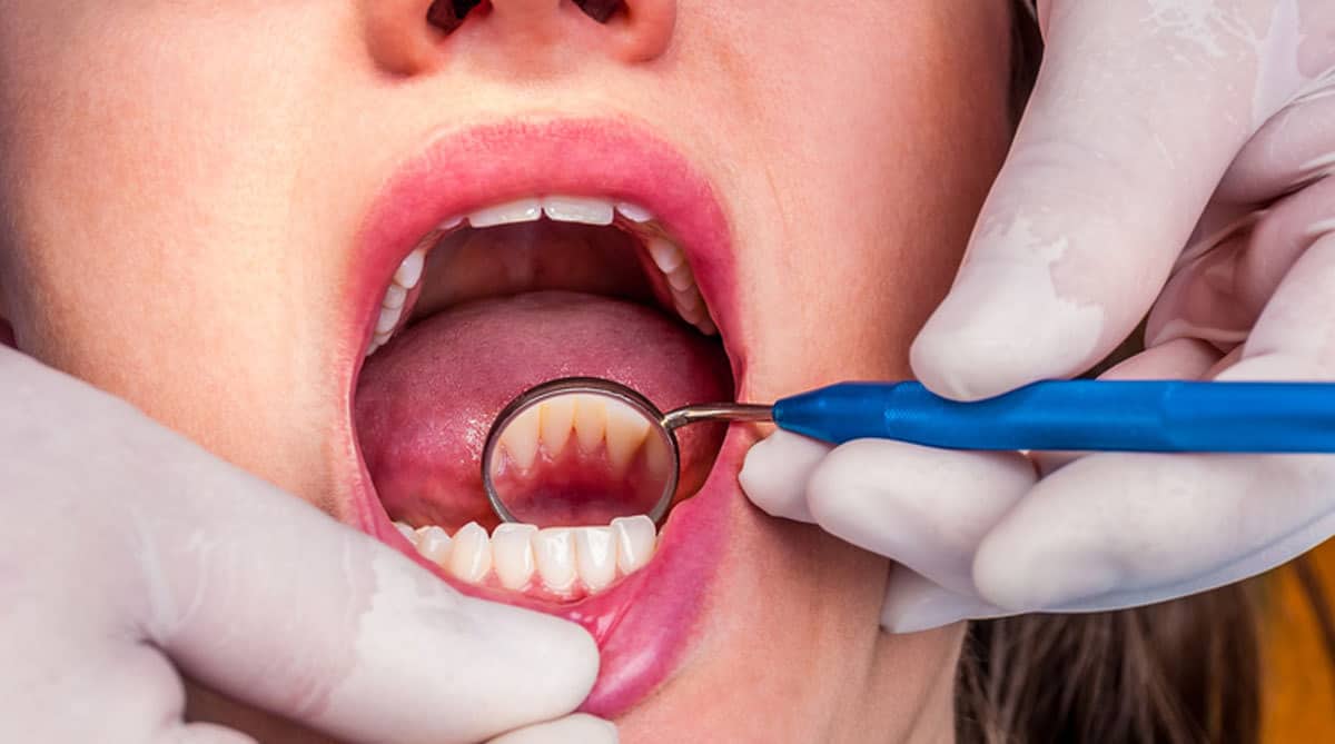 What are the Most Common Dental Issues and How do I Resolve Them?